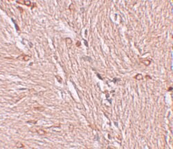 Invitrogen ZBTB4 Polyclonal Antibody 100 μg; Unconjugated:Antibodies,