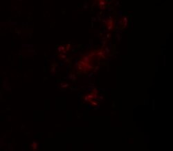 Invitrogen ZBTB5 Polyclonal Antibody 100 &mu;g | Buy Online | Invitrogen&trade; | Fisher Scientific