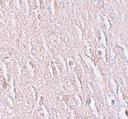 Invitrogen&trade;&nbsp;ZBTB5 Polyclonal Antibody