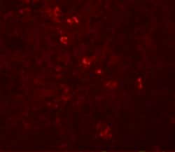 Invitrogen ZBTB8A Polyclonal Antibody 100 &mu;g; Unconjugated:Anticuerpos