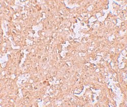 Invitrogen ZBTB8A Polyclonal Antibody 100 &mu;g; Unconjugated:Anticuerpos