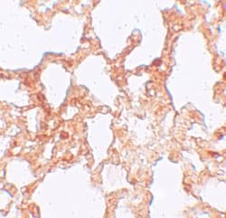 Invitrogen ZMYM1 Polyclonal Antibody 100 &mu;g | Buy Online | Invitrogen&trade; | Fisher Scientific