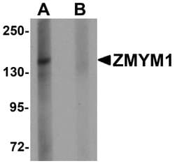 Invitrogen ZMYM1 Polyclonal Antibody 100 &mu;g | Buy Online | Invitrogen&trade; | Fisher Scientific