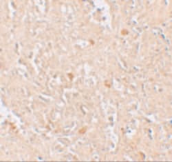 Invitrogen FBXL16 Polyclonal Antibody 100 μg; Unconjugated:Antibodies,