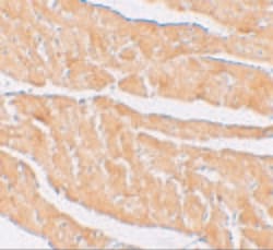 Invitrogen ZBTB9 Polyclonal Antibody 100 &mu;g; Unconjugated:Antibodies,