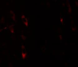 Invitrogen LRRTM1 Polyclonal Antibody 100 &mu;g; Unconjugated:Antibodies,