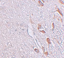 Invitrogen LRRTM1 Polyclonal Antibody 100 &mu;g; Unconjugated:Antibodies,