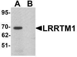 Invitrogen LRRTM1 Polyclonal Antibody 100 &mu;g; Unconjugated:Antibodies,