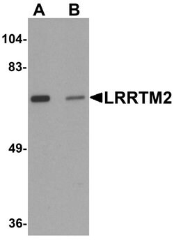 Invitrogen LRRTM2 Polyclonal Antibody 100 &mu;g | Buy Online | Invitrogen&trade; | Fisher Scientific