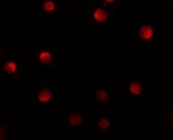 Invitrogen N4BP1 Polyclonal Antibody 100 &mu;g; Unconjugated:Antibodies,