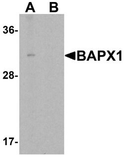 Invitrogen Nkx3.2 Polyclonal Antibody 100 &mu;g | Buy Online | Invitrogen&trade; | Fisher Scientific