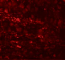 Invitrogen ESRP1 Polyclonal Antibody 100 &mu;g; Unconjugated:Antibodies,