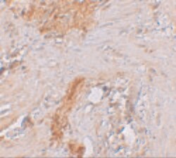 Invitrogen ESRP1 Polyclonal Antibody 100 &mu;g; Unconjugated:Antibodies,