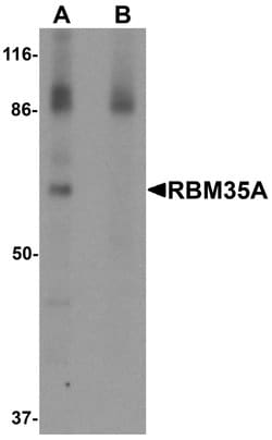 Invitrogen ESRP1 Polyclonal Antibody 100 &mu;g; Unconjugated:Antibodies,