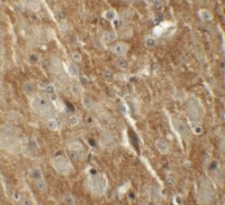 Invitrogen CTNNBL1 Polyclonal Antibody 100 μg; Unconjugated:Antibodies,