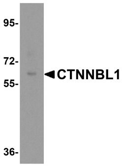 Invitrogen CTNNBL1 Polyclonal Antibody 100 μg; Unconjugated:Antibodies,
