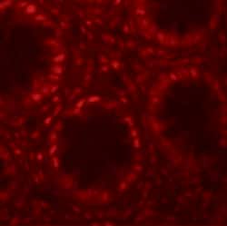 Invitrogen LRRFIP1 Polyclonal Antibody 100 &mu;g | Buy Online | Invitrogen&trade; | Fisher Scientific