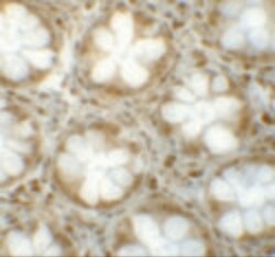 Invitrogen LRRFIP1 Polyclonal Antibody 100 &mu;g | Buy Online | Invitrogen&trade; | Fisher Scientific