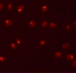 Invitrogen ZNF281 Polyclonal Antibody 100 &mu;g; Unconjugated:Antibodies,