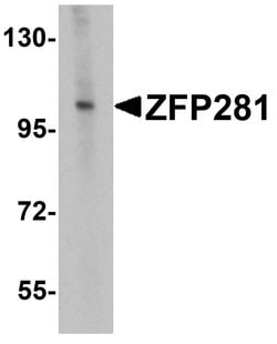 Invitrogen ZNF281 Polyclonal Antibody 100 &mu;g; Unconjugated:Antibodies,