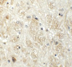 Invitrogen PRR5 Polyclonal Antibody 100 &mu;g | Buy Online | Invitrogen&trade; | Fisher Scientific