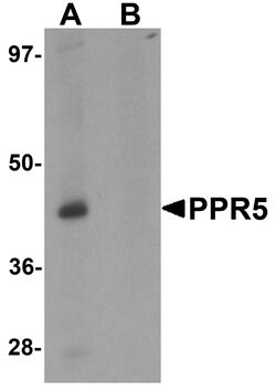 Invitrogen PRR5 Polyclonal Antibody 100 &mu;g | Buy Online | Invitrogen&trade; | Fisher Scientific