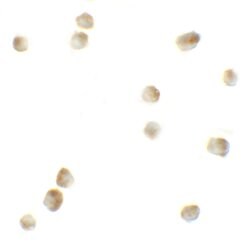 Invitrogen ROCK1 Polyclonal Antibody 100 &mu;g | Buy Online | Invitrogen&trade; | Fisher Scientific