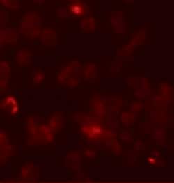 Invitrogen ROCK1 Polyclonal Antibody 100 &mu;g | Buy Online | Invitrogen&trade; | Fisher Scientific