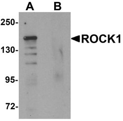 Invitrogen ROCK1 Polyclonal Antibody 100 &mu;g | Buy Online | Invitrogen&trade; | Fisher Scientific