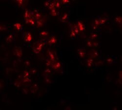 Invitrogen EZH2 Polyclonal Antibody 100 &mu;g | Buy Online | Invitrogen&trade; | Fisher Scientific