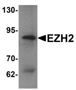 Invitrogen EZH2 Polyclonal Antibody 100 &mu;g | Buy Online | Invitrogen&trade; | Fisher Scientific
