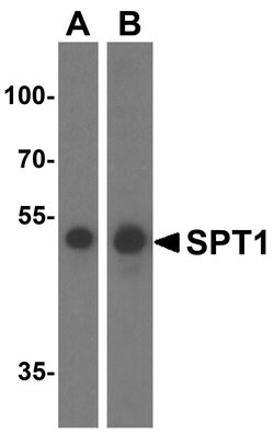Invitrogen SPTLC1 Polyclonal Antibody 100 &mu;g; Unconjugated:Antibodies,