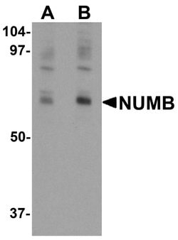Invitrogen NUMB Polyclonal Antibody 100 &mu;g; Unconjugated:Antibodies,