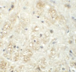 Invitrogen VASH1 Polyclonal Antibody 100 &mu;g | Buy Online | Invitrogen&trade; | Fisher Scientific