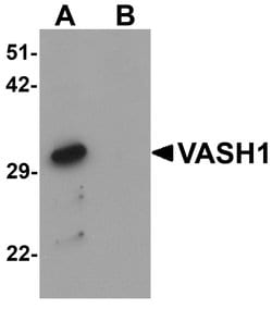 Invitrogen VASH1 Polyclonal Antibody 100 &mu;g | Buy Online | Invitrogen&trade; | Fisher Scientific
