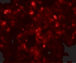 Invitrogen TSN Polyclonal Antibody 100 &mu;g | Buy Online | Invitrogen&trade; | Fisher Scientific