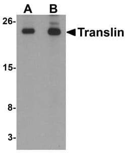 Invitrogen TSN Polyclonal Antibody 100 &mu;g | Buy Online | Invitrogen&trade; | Fisher Scientific