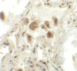 Invitrogen RASSF10 Polyclonal Antibody 100 &mu;g; Unconjugated:Antibodies,