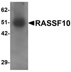 Invitrogen RASSF10 Polyclonal Antibody 100 &mu;g; Unconjugated:Antibodies,