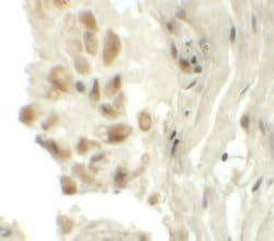 Invitrogen TYW1 Polyclonal Antibody 100 &mu;g; Unconjugated:Antibodies,