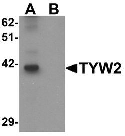 Invitrogen TRMT12 Polyclonal Antibody 100 &mu;g; Unconjugated:Antibodies,