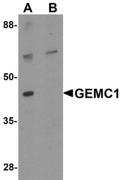 GEMC1 Polyclonal Antibody, Invitrogen 100 &mu;g; Unconjugated:Antibodies