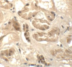 Invitrogen ATAD3B Polyclonal Antibody 100 &mu;g; Unconjugated:Antibodies,