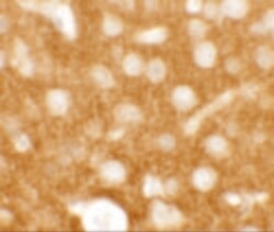 Invitrogen TMEM88 Polyclonal Antibody 100 &mu;g | Buy Online | Invitrogen&trade; | Fisher Scientific