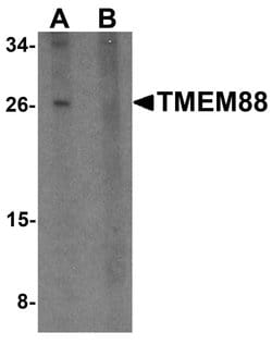 Invitrogen TMEM88 Polyclonal Antibody 100 &mu;g | Buy Online | Invitrogen&trade; | Fisher Scientific