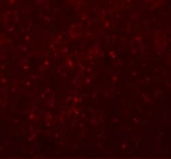 Invitrogen CCDC141 Polyclonal Antibody 100 μg; Unconjugated:Antibodies,