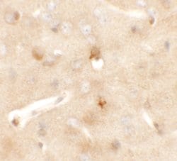 Invitrogen CCDC141 Polyclonal Antibody 100 μg; Unconjugated:Antibodies,