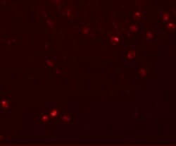 Invitrogen SPRYD3 Polyclonal Antibody 100 &mu;g; Unconjugated:Antibodies,