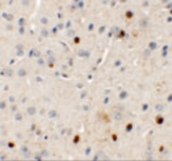 Invitrogen SPRYD3 Polyclonal Antibody 100 &mu;g; Unconjugated:Antibodies,