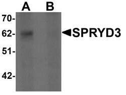 Invitrogen SPRYD3 Polyclonal Antibody 100 &mu;g; Unconjugated:Antibodies,